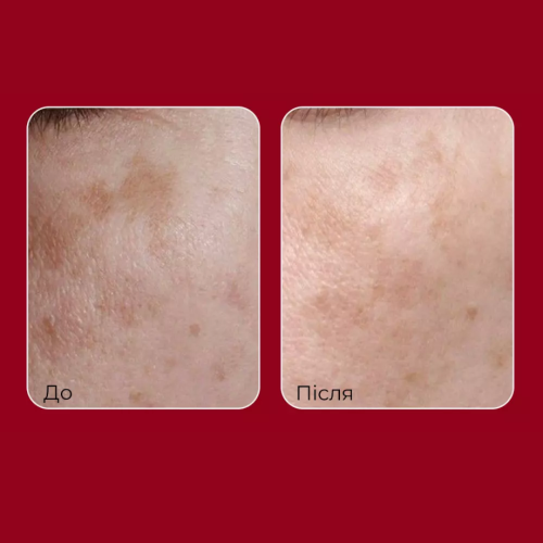 Тонер для обличчя з ретинолом і колагеном MEDIPEEL Retinol Collagen Lifting Toner, 150 мл