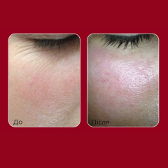 Крем для обличчя з ретинолом і колагеном MEDIPEEL Retinol Collagen Lifting Cream, 50 мл
