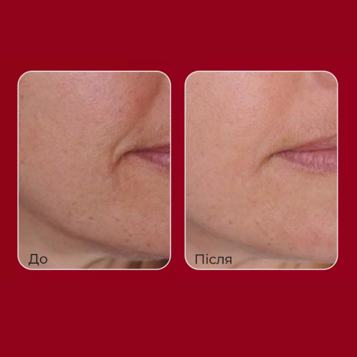 Сироватка з ретинолом і колагеном MEDIPEEL Retinol Collagen Lifting Ampoule, 50 мл