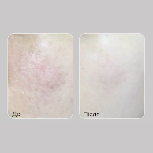 Пінка для вмивання зволожувальна MEDIPEEL Peptide 9 Aqua Essence Facial Cleanser, 150 мл