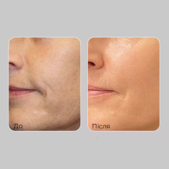 Крем для лица антивозрастной MEDIPEEL Peptide 9 Volume and Tension Tox Cream PRO, 50 мл