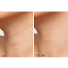 Підтягуючий стік для шиї з пептидним комплексом MEDIPEEL Premium Naite 1000 Shot Neck Stick 2.0, 20 г