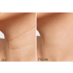 Підтягуючий стік для шиї з пептидним комплексом MEDIPEEL Premium Naite 1000 Shot Neck Stick 2.0, 20 г