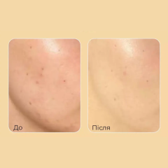 Сироватка для обличчя із золотом Medi-Peel 24К Luxury 24K Gold Ampoule, 100 мл