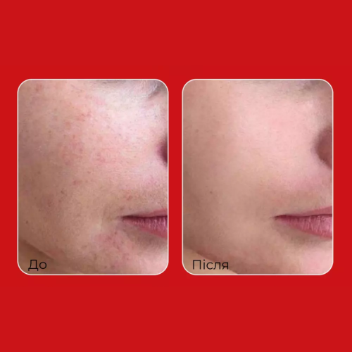 Освітлювальний крем для обличчя проти пігментації MEDIPEEL Melanon X Cream, 30 мл