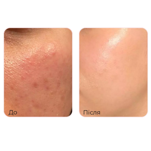 Тонер заспокійливий з колагеном та лактобактеріями Medi-Peel Red Lacto Collagen Soothing Essence Toner 200 ml