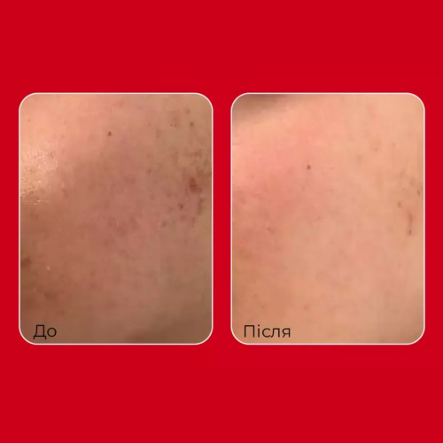 Крем захисний з пептидами та лактобактеріями Medi-Peel Red Lacto Peptide Collagen Barrier Cream 80 ml