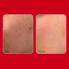 Крем захисний з пептидами та лактобактеріями Medi-Peel Red Lacto Peptide Collagen Barrier Cream 80 ml