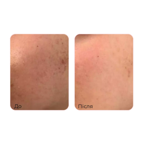 Маска з колагеном та лактобактеріями Medi-Peel Red Lacto Collagen Pore Lifting Mask