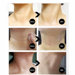 Ліфтинг-крем для шиї з пептидами та колагеном MEDIPEEL Premium Collagen Naite Thread Neck Cream 100ml