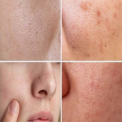 Маска порозвужуюча для обличчя Sungboon Editor Green Tomato Pore Lifting Ampoule Mask