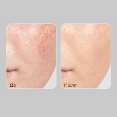 Сироватка для обличчя з комплексом вітанолу MEDIPEEL Peptide 9 Vitanol Ampoule Pro, 30 мл