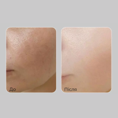 Крем для обличчя з пептидами з комплексом вітанолу MEDIPEEL Peptide 9 Vitanol Cream Pro, 50g